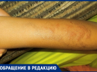 В Анапе Ксения Бебиашвили заплатила 4000 р. за тату, превратившиеся в рубцы и волдыри
