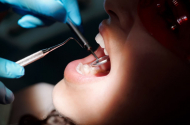 Диагностика зубов в клинике «Ваша стоматология»  - 