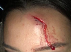 В Анапе нашли мужчину, который разбил голову работнице тира