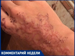 Анапский дерматолог Игорь Клименко рассказал, какую опасность таят временные тату