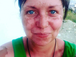 «Обидно, что нас не искали»: пара, выживавшая пять дней в открытом море, рассказала свою историю 