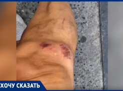 Анапчанка разбила в кровь колени, упав на тротуаре на улице Толстого