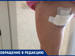 «Крики, швы на ногах и испуг»: на анапчанку напала стая собак