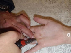  Анапчанке пришлось вызывать спасателей, чтобы снять кольцо с пальца