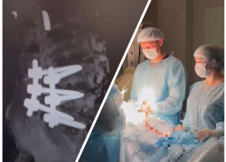 Впервые в истории Анапы: нейрохирурги провели операцию по лечению патологии позвоночника с помощью имплантатов