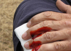 Анапчанин попал в переделку и был вынужден самостоятельно останавливать кровотечение