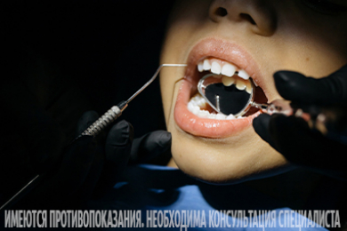 Лечение зубов у детей в клинике «Ваша стоматология»