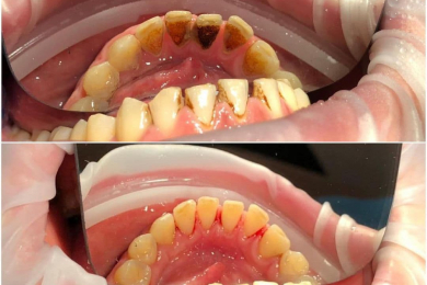Лечение зубов в клинике «Ваша стоматология» - 