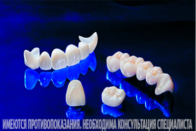 Изготовление и установка коронок в клинике «Ваша стоматология»