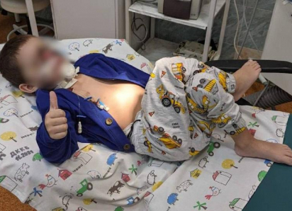 Мальчику с откушенным лицом успешно пересадили кожу во Владикавказе – благодаря микрохирургу из Анапы