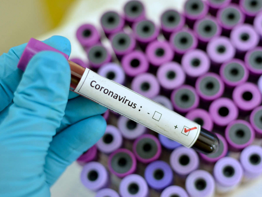 В Анапу опасный коронавирус не просочится: специалисты работают, как часы