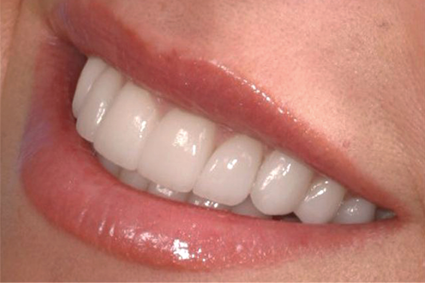 Хочешь иметь белоснежную улыбку? Заходи в справочник